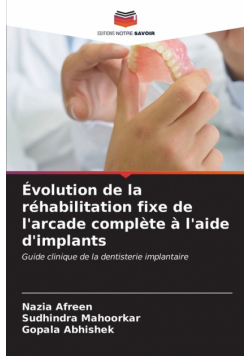 Évolution de la réhabilitation fixe de l'arcade complète à l'aide d'implants