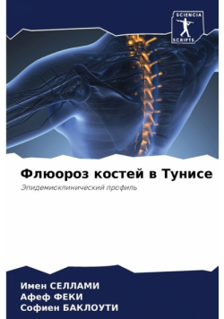Флюороз костей в Тунисе