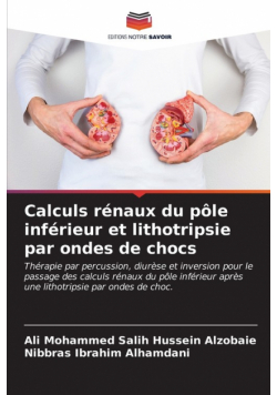 Calculs rénaux du pôle inférieur et lithotripsie par ondes de chocs