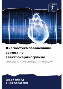 Диагностика заболеваний сердца по электрокардиограмме