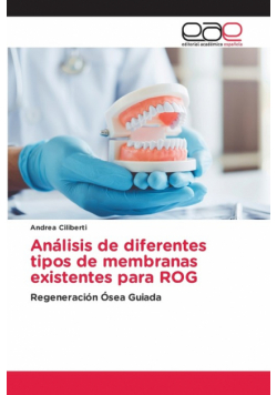 Análisis de diferentes tipos de membranas existentes para ROG