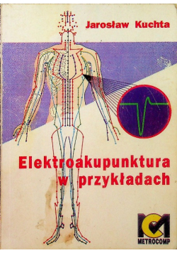 Elektroakupunktura w przykładach