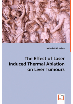 The Effect of Laser Induced Thermal Ablation on Liver Tumours
