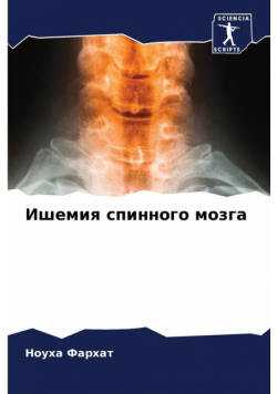 Ишемия спинного мозга