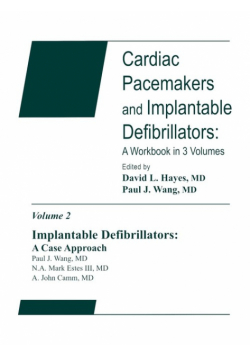 Cardiac Pacemakers V2
