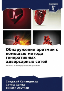 Обнаружение аритмии с помощью метода генеративных адверсарных сетей