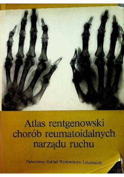 Atlas rentgenowski chorób reumatoidalnych narządu ruchu
