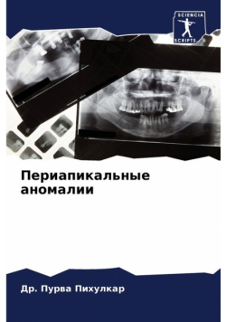 Периапикальные аномалии
