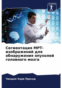 Сегментация МРТ-изображений для обнаружения опухолей головного мозга