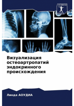 Визуализация остеоартропатий эндокринного происхождения