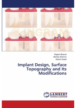 Implant Design, Surface Topography and Its Modifications