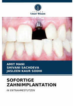 Sofortige Zahnimplantation
