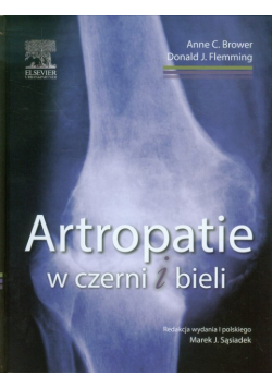 Artropatie w czerni i bieli