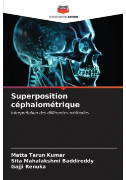Superposition céphalométrique