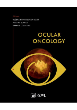 Ocular Oncology