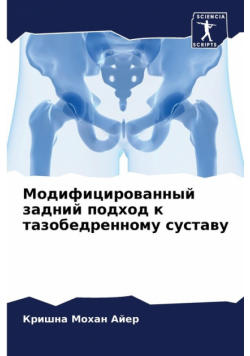 Модифицированный задний подход к тазобедренному суставу
