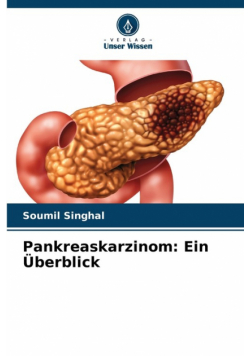 Pankreaskarzinom