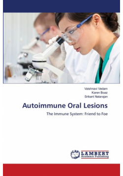 Autoimmune Oral Lesions