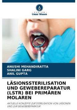 Läsionssterilisation Und Gewebereparatur (Lstr) Bei Primären Molaren
