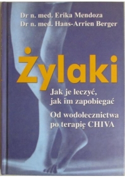 Żylaki