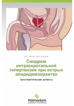 Sindrom Intraskrotal'noy Gipertenzii Pri Ostrykh Epididimoorkhitakh