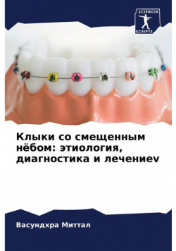 Клыки со смещенным нёбом