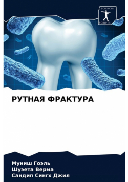 РУТНАЯ ФРАКТУРА