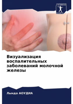 Визуализация воспалительных заболеваний молочной железы