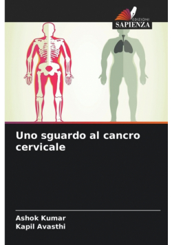 Uno sguardo al cancro cervicale