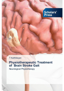 Physiotherapeutic Treatment of Brain Stroke Gait