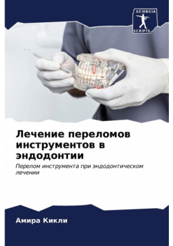 Лечение переломов инструментов в эндодонтии