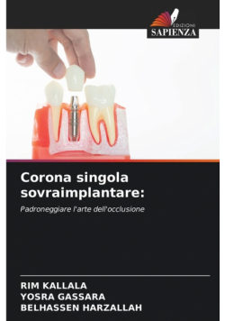 Corona singola sovraimplantare