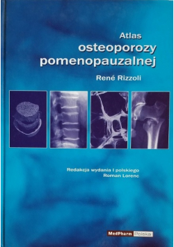 Atlas osteoporozy pomenopauzalnej