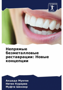 Непрямые безметалловые реставрации