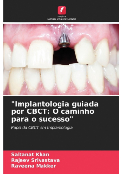 "Implantologia guiada por CBCT
