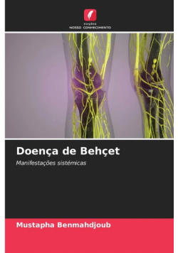 Doença de Behçet