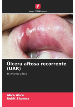 Úlcera aftosa recorrente (UAR)