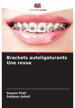 Brackets autoligaturants Une revue