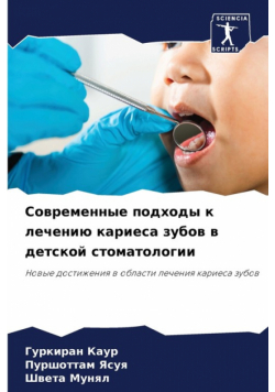 Современные подходы к лечению кариеса зубов в детской стоматологии