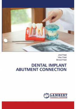 Dental Implant Abutment Connection