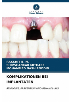 Komplikationen Bei Implantaten