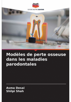 Modèles de perte osseuse dans les maladies parodontales