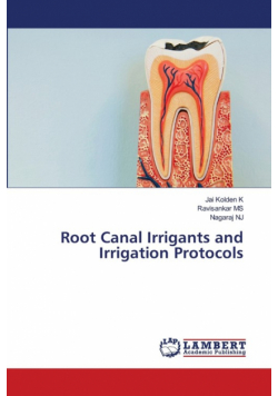 Root Canal Irrigants and Irrigation Protocols