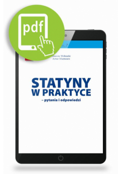 Statyny w praktyce - pytania i odpowiedzi