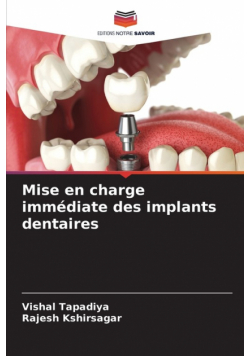 Mise en charge immédiate des implants dentaires