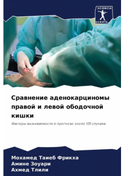 Сравнение аденокарциномы правой и левой ободочной кишки