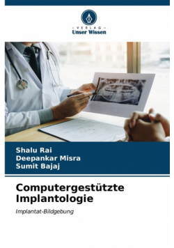 Computergestützte Implantologie