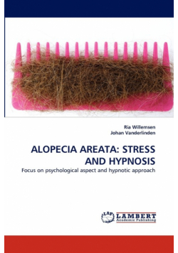 Alopecia Areata