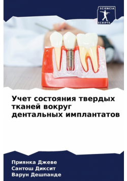 Учет состояния твердых тканей вокруг дентальных имплантатов