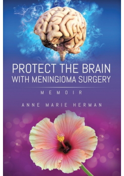 Protect the Brain with Meningioma Surgery